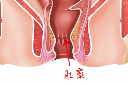 肛窦位置示意图