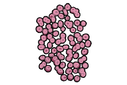 红细胞镜下形态图
