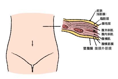 腹部筋膜层图解