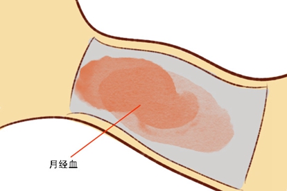 月经图片