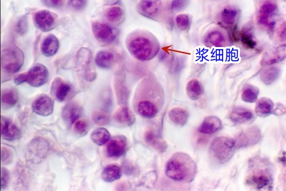 浆细胞切片图