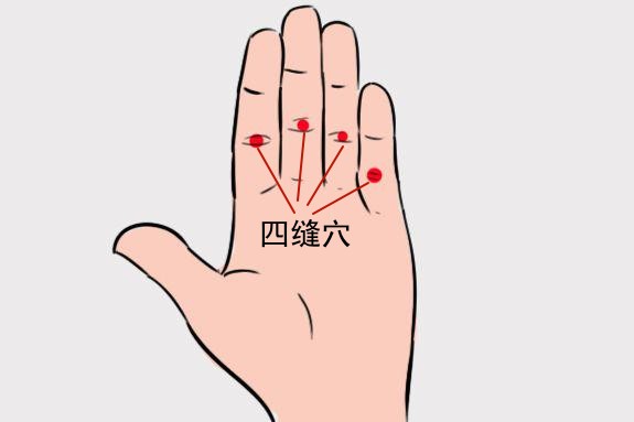 成人積食扎手指放血位置圖