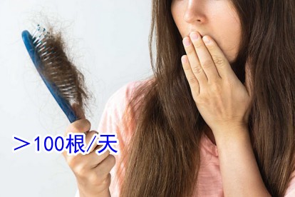 掉頭發不正常的圖片
