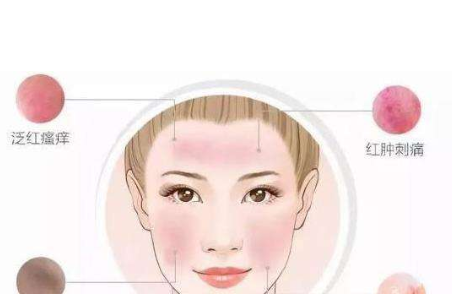 脸上皮肤过敏急救方法